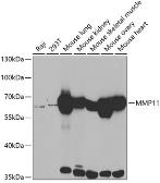 Anti-MMP11 antibody used in Western Blot (WB). GTX54369