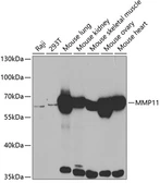 Anti-MMP11 antibody used in Western Blot (WB). GTX54369