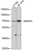 Anti-MMP25 antibody used in Western Blot (WB). GTX54370