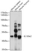 Anti-IL13 Receptor alpha 2 antibody used in Western Blot (WB). GTX54375