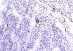Anti-CXCL10 / IP10 antibody [6D4] used in IHC (Frozen sections) (IHC-Fr). GTX54425