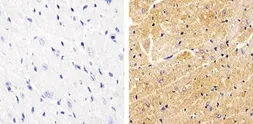 Anti-Vinculin (phospho Tyr822) antibody used in IHC (Paraffin sections) (IHC-P). GTX54519