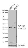 Anti-GATA4 antibody used in Western Blot (WB). GTX54530