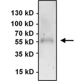Anti-PAX7 antibody used in Immunoprecipitation (IP). GTX54533