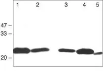 Anti-Claudin 1 antibody used in Western Blot (WB). GTX54539