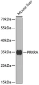 Anti-PACT antibody used in Western Blot (WB). GTX54546