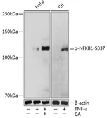 Anti-NFkB p105/p50 (phospho Ser337) antibody used in Western Blot (WB). GTX54547