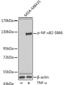 Anti-NFkB p100 (phospho Ser866) antibody used in Western Blot (WB). GTX54550
