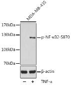 Anti-NFkB p100 (phospho Ser870) antibody used in Western Blot (WB). GTX54551