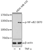 Anti-NFkB p100 (phospho Ser870) antibody used in Western Blot (WB). GTX54551