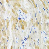 Anti-PHPT1 antibody used in IHC (Paraffin sections) (IHC-P). GTX54556
