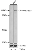 Anti-NFkB p105 (phospho Ser907) antibody used in Western Blot (WB). GTX54560