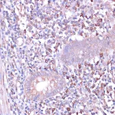Anti-PKA beta (catalytic subunit) antibody used in IHC (Paraffin sections) (IHC-P). GTX54564