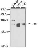 Anti-TSSC3 antibody used in Western Blot (WB). GTX54573