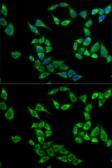 Anti-TSSC3 antibody used in Immunocytochemistry/ Immunofluorescence (ICC/IF). GTX54573