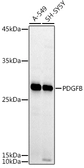 Anti-PDGF beta antibody used in Western Blot (WB). GTX54575