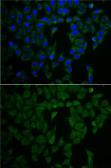 Anti-Merlin antibody used in Immunocytochemistry/ Immunofluorescence (ICC/IF). GTX54576