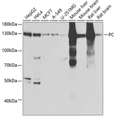 Anti-Pyruvate Carboxylase antibody used in Western Blot (WB). GTX54577