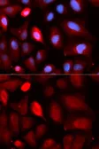 Anti-PDLIM5 antibody used in Immunocytochemistry/ Immunofluorescence (ICC/IF). GTX54578