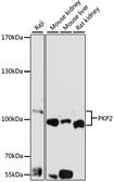 Anti-PKP2 antibody used in Western Blot (WB). GTX54579