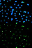 Anti-PSAP antibody used in Immunocytochemistry/ Immunofluorescence (ICC/IF). GTX54581
