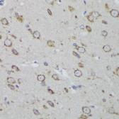 Anti-PSAP antibody used in IHC (Paraffin sections) (IHC-P). GTX54581