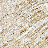 Anti-PSMA3 antibody used in Immunoprecipitation (IP). GTX54582