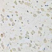 Anti-PSMC2 antibody used in IHC (Paraffin sections) (IHC-P). GTX54583