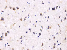 Anti-PPP2R4 antibody used in IHC (Paraffin sections) (IHC-P). GTX54592