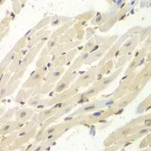 Anti-PSME1 antibody used in IHC (Paraffin sections) (IHC-P). GTX54593