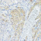 Anti-NOD1 antibody used in IHC (Paraffin sections) (IHC-P). GTX54595