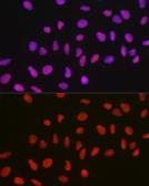 Anti-p54nrb antibody used in Immunocytochemistry/ Immunofluorescence (ICC/IF). GTX54596