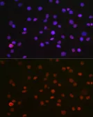 Anti-p54nrb antibody used in Immunocytochemistry/ Immunofluorescence (ICC/IF). GTX54596