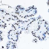 Anti-p54nrb antibody used in IHC (Paraffin sections) (IHC-P). GTX54596