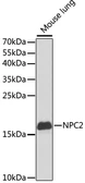 Anti-NPC2 antibody used in Western Blot (WB). GTX54597