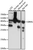 Anti-alpha 1 Acid Glycoprotein antibody used in Western Blot (WB). GTX54601