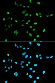 Anti-PAX2 antibody used in Immunocytochemistry/ Immunofluorescence (ICC/IF). GTX54602