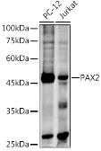 Anti-PAX2 antibody used in Western Blot (WB). GTX54602