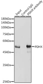Anti-PDHX antibody used in Immunoprecipitation (IP). GTX54603