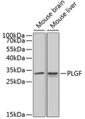 Anti-PLGF antibody used in Western Blot (WB). GTX54606