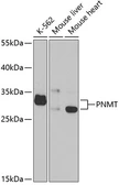 Anti-PNMT antibody used in Western Blot (WB). GTX54609