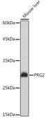 Anti-PRG2 antibody used in Western Blot (WB). GTX54611