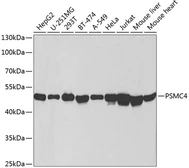 Anti-PSMC4 antibody used in Western Blot (WB). GTX54612