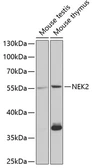 Anti-NEK2 antibody used in Western Blot (WB). GTX54614