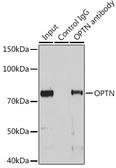 Anti-Optineurin antibody used in Immunoprecipitation (IP). GTX54617