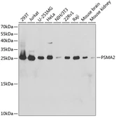 Anti-Proteasome 20S alpha 2 antibody used in Western Blot (WB). GTX54618