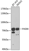 Anti-PAD4 antibody used in Western Blot (WB). GTX54621