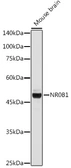 Anti-NR0B1 antibody used in Western Blot (WB). GTX54624