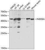Anti-PARD6A antibody used in Western Blot (WB). GTX54628