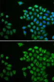 Anti-TCPTP antibody used in Immunocytochemistry/ Immunofluorescence (ICC/IF). GTX54634